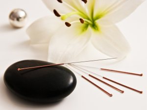 Acupuncture healing session in a clinic with a focus on natural healing techniques. The benefits of acupuncture for back pain, anxiety, and overall wellness are emphasized