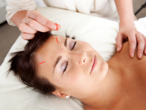 Sterile acupuncture needle placed on the forehead to highlight acupuncture safety and its use for pregnancy. Explore benefits of acupuncture, auricular acupuncture, and cupping