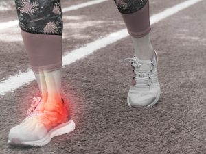 Visual guide for treating ankle conditions, including sprains, ligament strains, fractures, and first aid for recovery